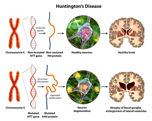 Molecular genesis of Huntington's disease, illustration. Expansion of the CAG trinucleotide sequence in the htt gene causes production of mutated Huntingtin protein leading to neurodegeneration.